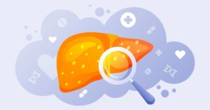 Read more about the article Ayurvedic treatment for Liver Cancer in Mumbai, Navi Mumbai & Thane