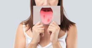 Read more about the article Ayurvedic treatment for Mouth Cancer in Mumbai, Navi Mumbai & Thane